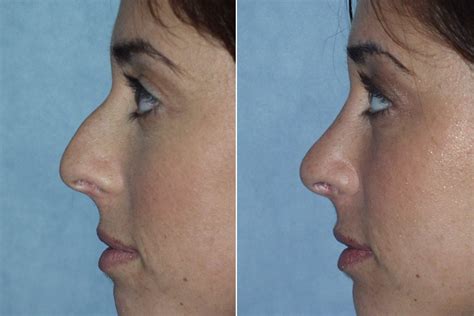 Plastic Surgery, Made Simple. .